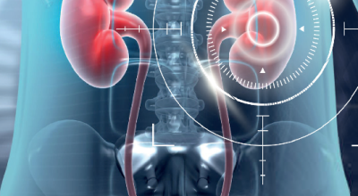 # FOCUS ON URONCOLOGIA