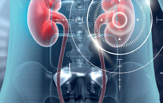 # FOCUS ON URONCOLOGIA